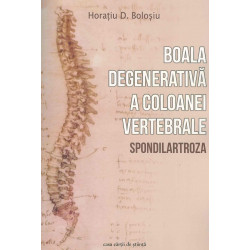 Boala degenerativa a coloniei vertebrale - Spondilartoza