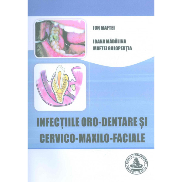 Infectiile oro-dentare si cervico-maxilo-faciale