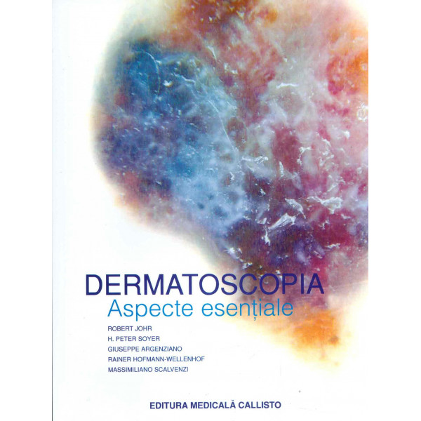 Dermatoscopia - Aspecte esentiale