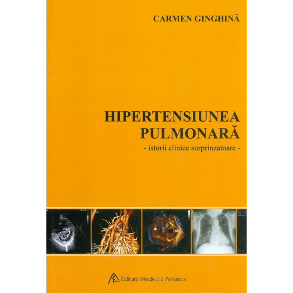 Hipertensiunea pulmonara - Istorii clinice surprinzatoare