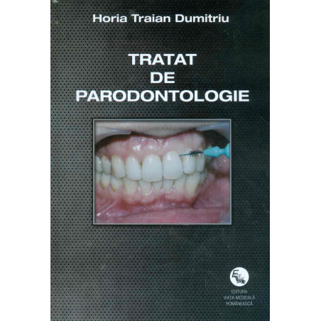 Tratat de parodontologie