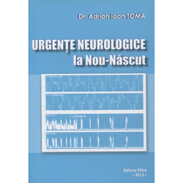 Urgente neurologice