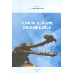 Tumori benigne rinosinusale