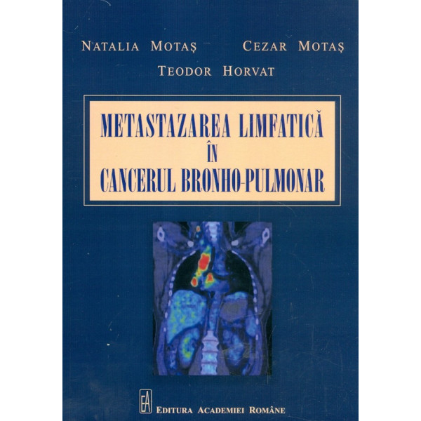 Metastazarea limfatica in cancerul bronho-pulmunar