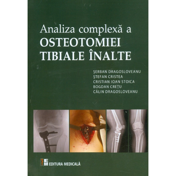 Analiza complexa a osteotomiei tibiale inalte