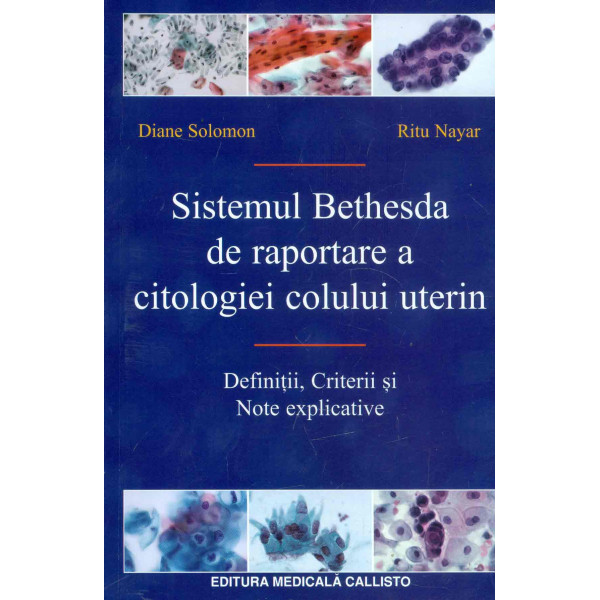 Sistemul Bethesda de raportare a citologiei colului uterin. Definitii, criterii si note explivative