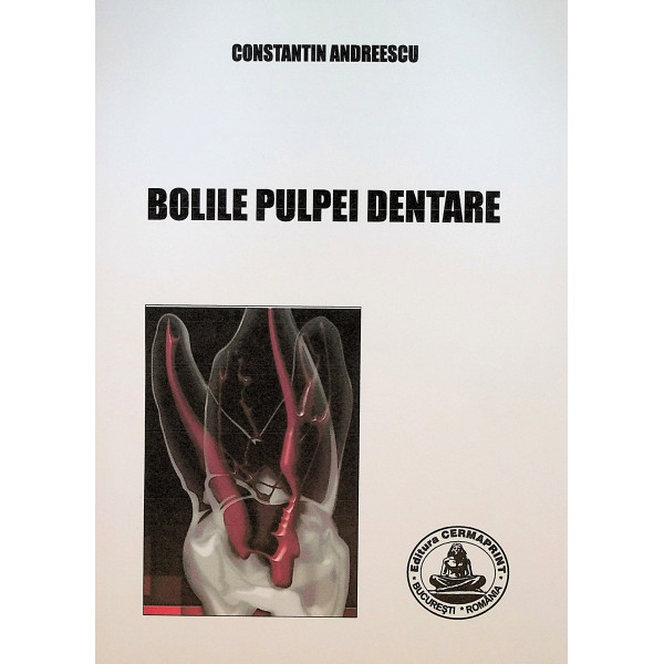 Bolile pulpei dentare