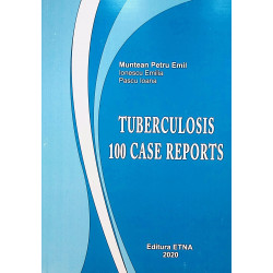 Tuberculosis 100 Case Reports
