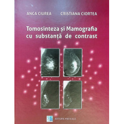 Tomosinteza si Mamografia...