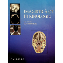 Imagistica CT in rinologie