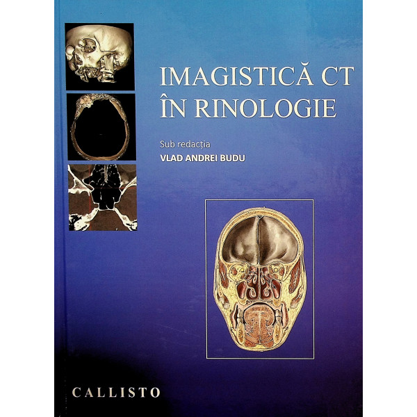 Imagistica CT in rinologie