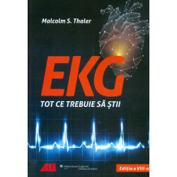 EKG - Tot ce trebuie sa stii