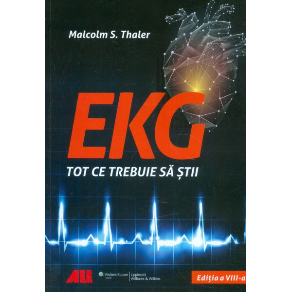EKG - Tot ce trebuie sa stii