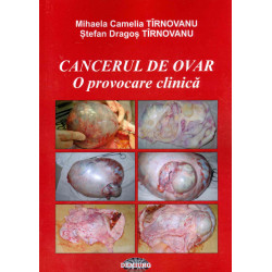 Cancerul de ovar. O...