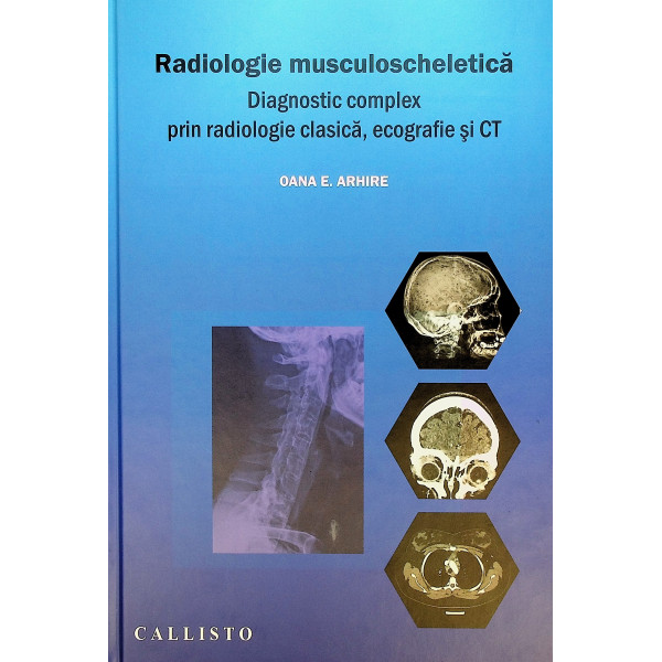 Radiologie musculoscheletica.Diagnostic complex prin radiologie clasica ,ecografie si CT