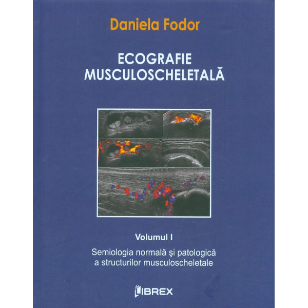 Ecografie musculoscheletala, vol. I - Semiologia normala si patologica a structurilor musculoscheletale