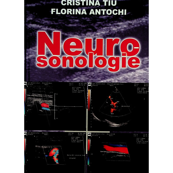 Neurosonologie