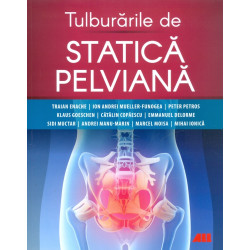 Tulburarile de statica...