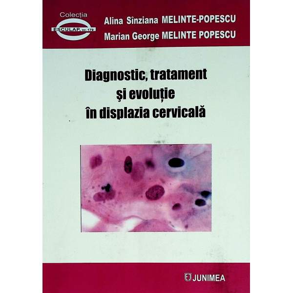 Diagnostic, tratament si evolutie in displazia cervicala